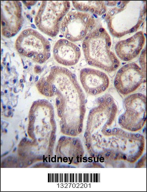Anti-SP140 (Center) Antibody