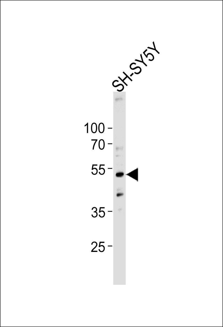 Anti-DCTN2 (Center) Antibody
