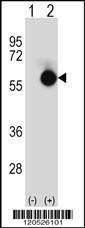 Anti-CTBP2 (N-term) Antibody