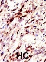 Anti-Pan SUMO Antibody