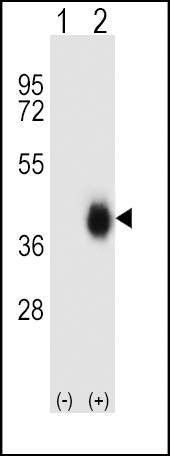 Anti-FCAR (Center) Antibody