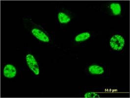 Anti-CCDC131 Antibody