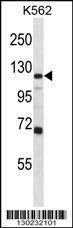 Anti-GRIA4 (Center) Antibody