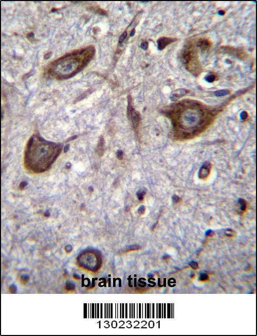 Anti-GRIA4 (Center) Antibody