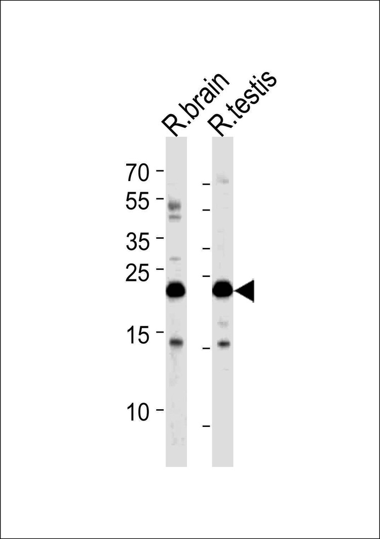 Anti-RAB11B (C-term) Antibody