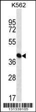 Anti-PAICS (N-term) Antibody