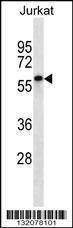 Anti-ENOX2 (N-term) Antibody