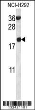 Anti-RPS12 (N-term) Antibody