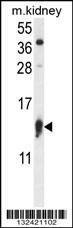 Anti-RPS12 (N-term) Antibody