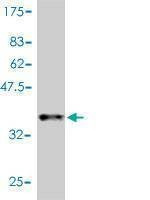 Anti-CCL11 Antibody