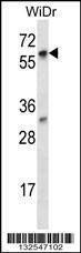 Anti-LARP7 (C-term) Antibody
