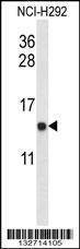 Anti-UQCRB (Center) Antibody