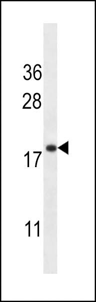 Anti-TMM70 (C-term) Antibody
