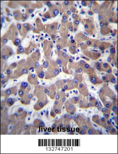 Anti-TMM70 (C-term) Antibody