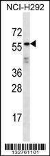 Anti-ODF2L (C-term) Antibody