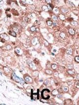 Anti-Bak (BH3 Domain Specific) Antibody