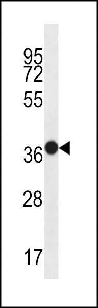 Anti-MUC15 (C-term) Antibody