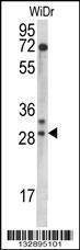 Anti-MRPL9 (N-term) Antibody