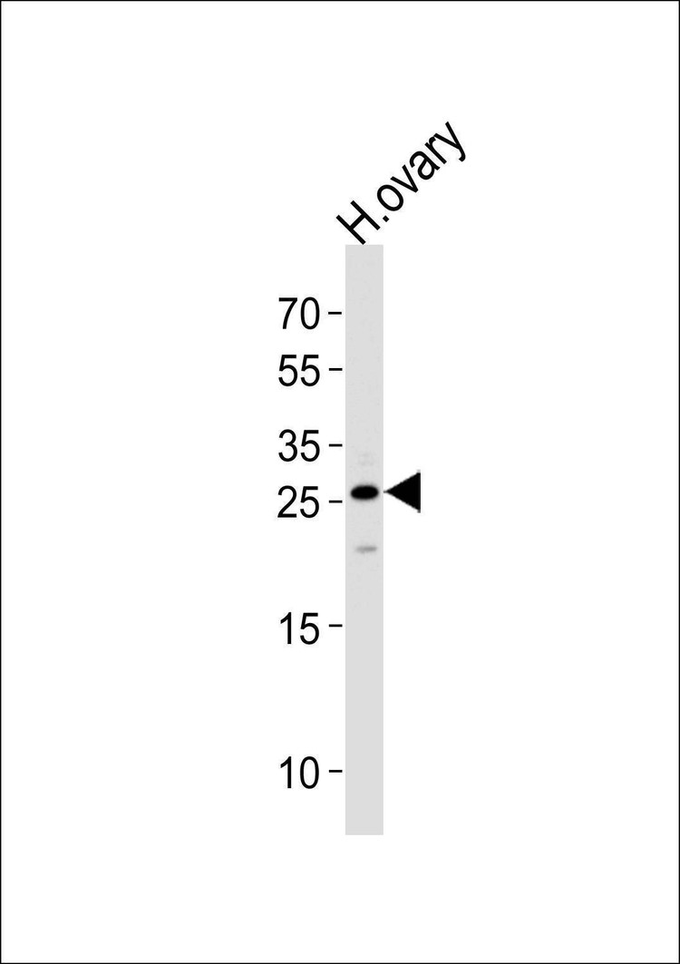 Anti-CCDC90B (Center) Antibody