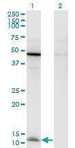 Anti-CCL2 Antibody