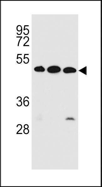 Anti-KREMEN2 (Center) Antibody