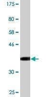 Anti-CCNT2 Antibody