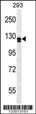 Anti-UNC5D (Center) Antibody