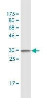 Anti-CCR2 Antibody