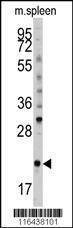 Anti-Mouse mouse BID (S61) Antibody