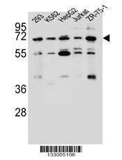 Anti-KCNV2 (C-term) Antibody