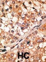 Anti-Bim BH3 Domain Antibody