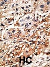 Anti-Bmf BH3 Domain Antibody