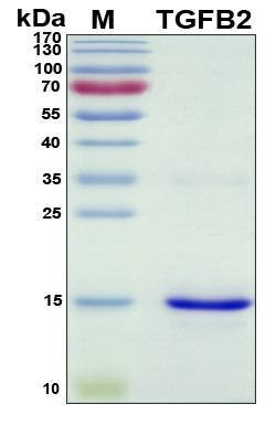 Recombinant Porcine (pig) TGFb2 Protein, Antigen Grade