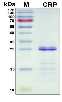 Recombinant Porcine (pig) CRP Protein, Antigen Grade