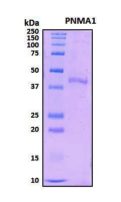 Recombinant Human Paraneoplastic Antigen Ma1 Protein