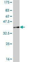 Anti-CCT2 Antibody