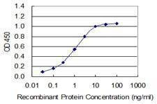 Anti-CCT2 Antibody
