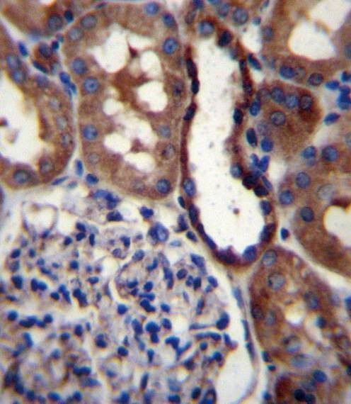Anti-Mouse GRIK3 (N-term) Antibody