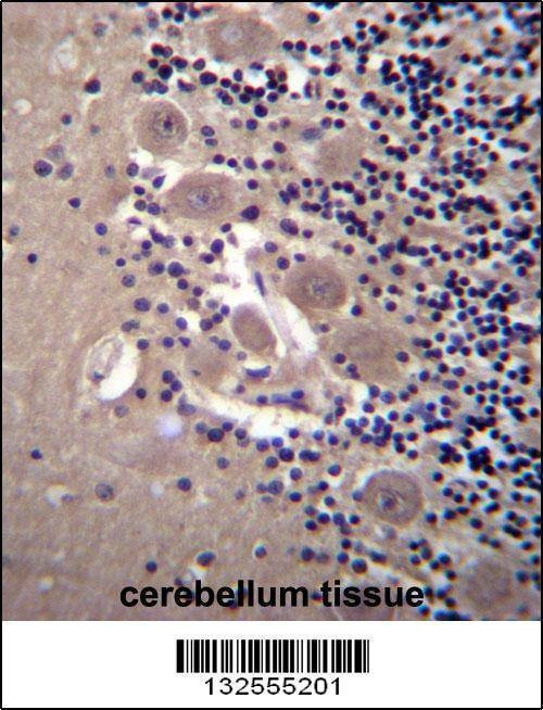 Anti-NPTXR (Center) Antibody