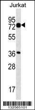 Anti-PLS1 (C-term) Antibody