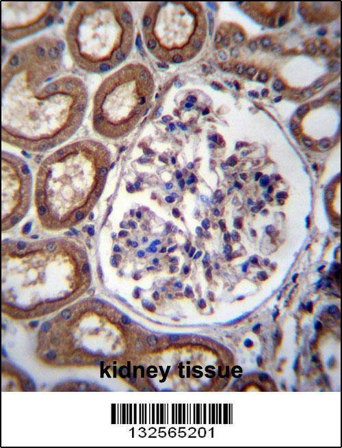 Anti-PLS1 (C-term) Antibody