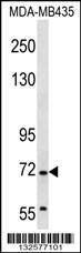 Anti-GRHL2 (Center) Antibody