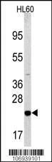 Anti-Bad (Center) Antibody