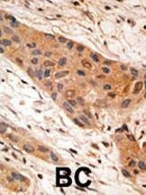 Anti-NIP1 (BH3 Domain Specific) Antibody