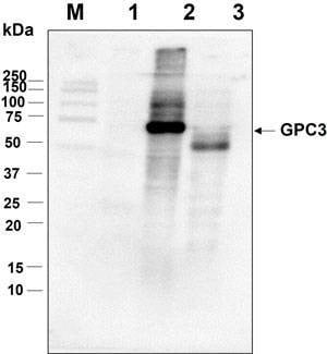 Anti-Glypican-3 (511~560aa) Antibody