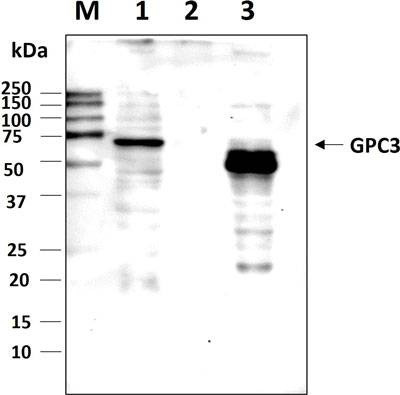 Anti-Glypican-3 (511~560aa) Antibody
