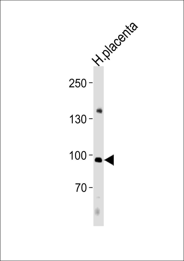 Anti-NFATC4 (C-term) Antibody