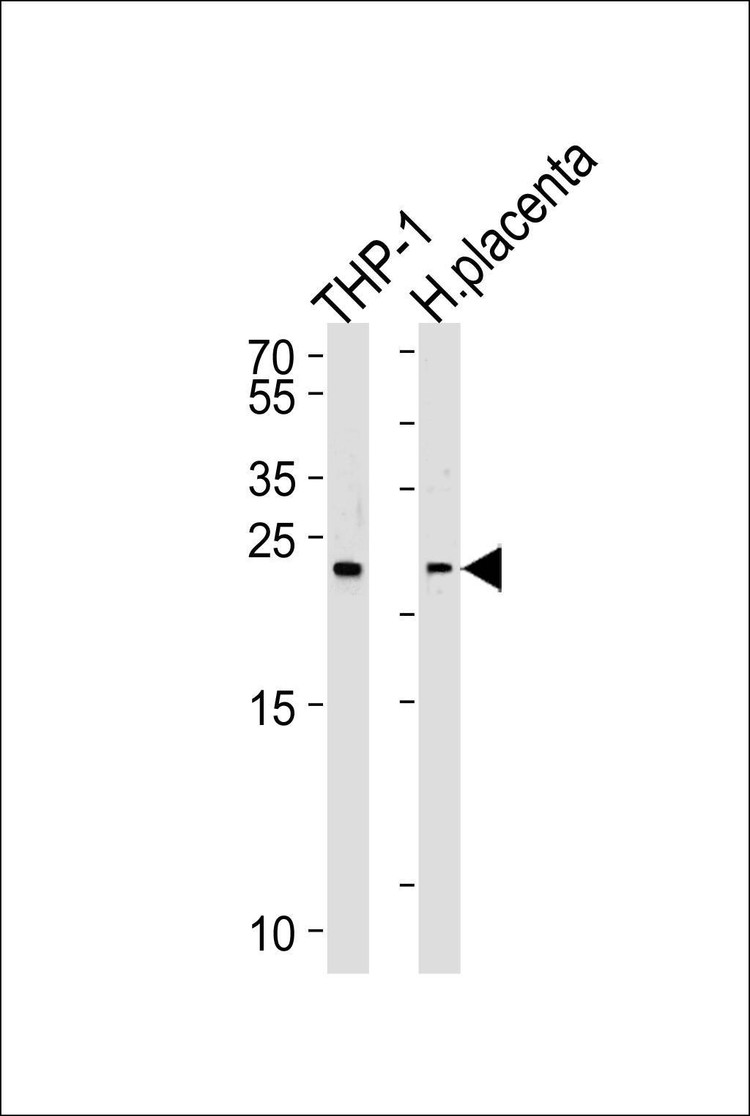 Anti-HEBP2 (N-term) Antibody