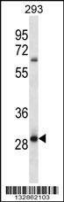 Anti-MRAP2 (Center) Antibody