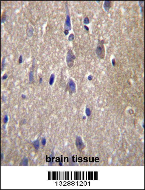 Anti-CPN2 (N-term) Antibody